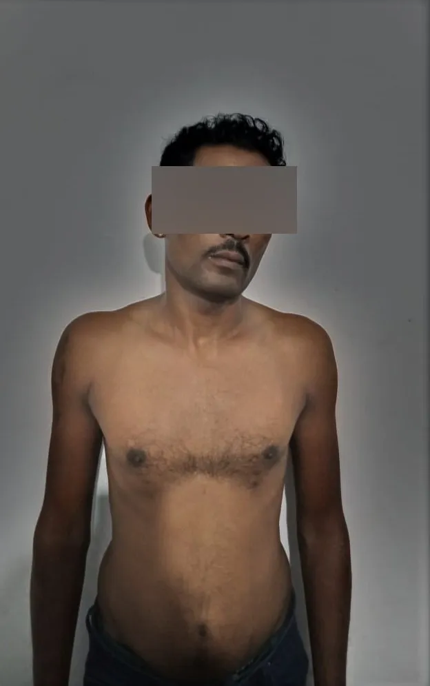 ගෝරිල්ලා රංජි හෙරොයින් සමග කොටුවෙයි 2 b4a1d3cb 110b 420b 8ef8 bba4466756fc