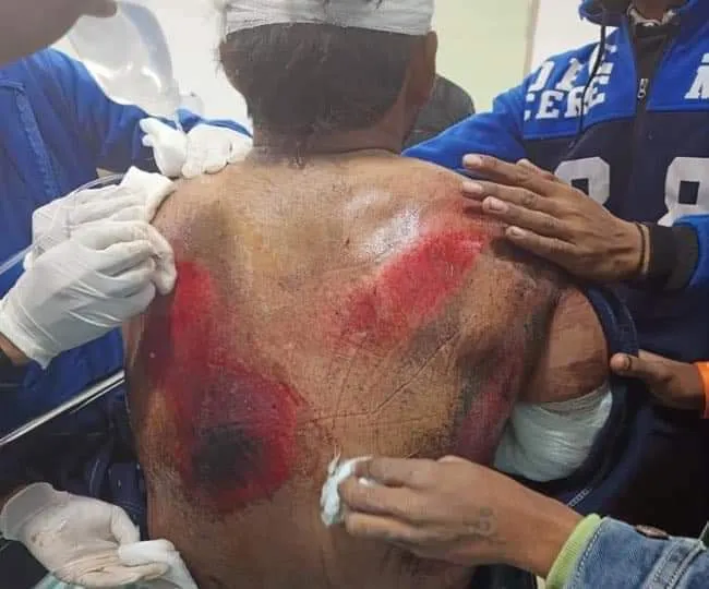 ඉන්දීය සුපිරි ක්රීඩක රිෂාබ් පාන්ට් රිය අනතුරකට ලක්වෙයි (ඡායාරූප) 3 WhatsApp Image 2022 12 30 at 9.39.14 AM