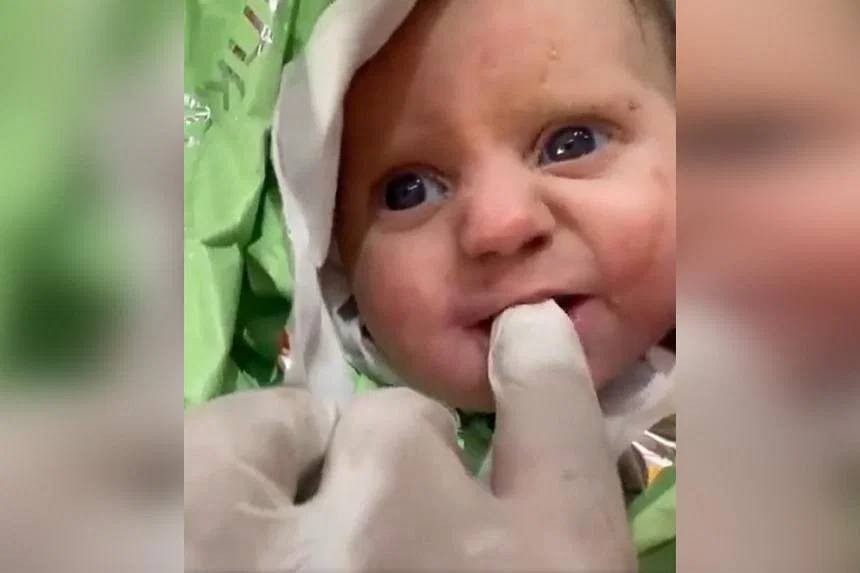 පැය 128ක් සුන්බුන් යට ජීවිතයත් මරණයත් අතර සටනක යෙදුනු මාස දෙකේ බිළිඳා (ඡායාරූප) 2 acbaby120223 0